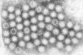 An electron micrograph of the Norovirus, with 27-32nm-sized viral particles (from CDC)