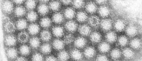 An electron micrograph of the Norovirus, with 27-32nm-sized viral particles (from CDC)
